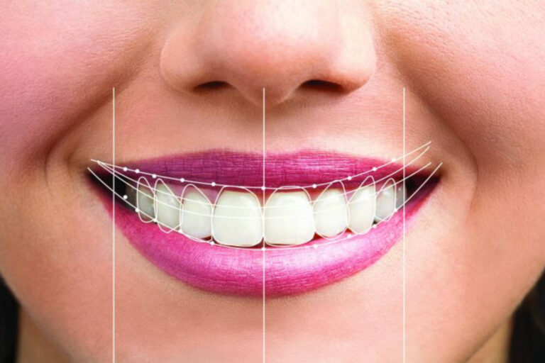 Smile