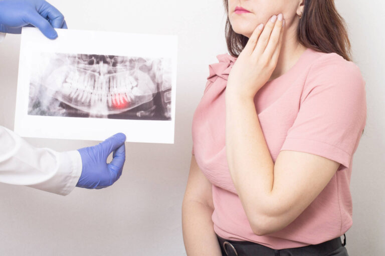 Wisdom Tooth