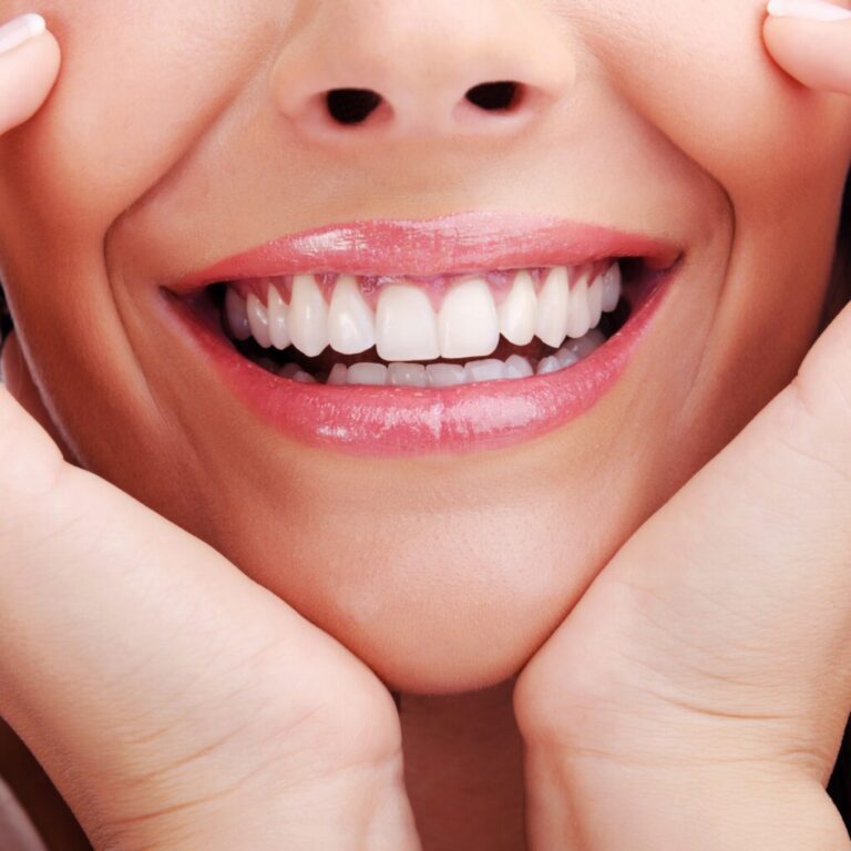 Smile